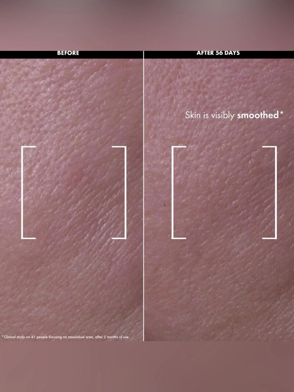 Sephora Collection Lift & Firm Recovery Firming Night Oil with Retinol